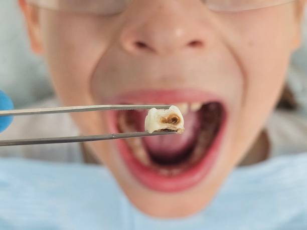 Best Broken Tooth Emergency  in Oak Grove Heights, AR