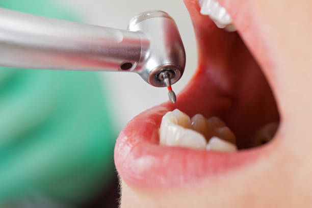 Best Cracked Tooth Emergency Dentist  in Oak Grove Heights, AR